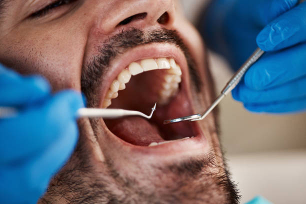 Best Same-Day Emergency Dentist in Tecumseh, MI