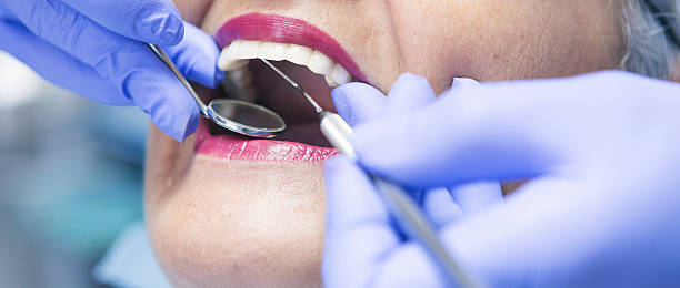 Best Emergency Wisdom Teeth Removal in Tecumseh, MI